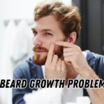 Beard Growth Problems