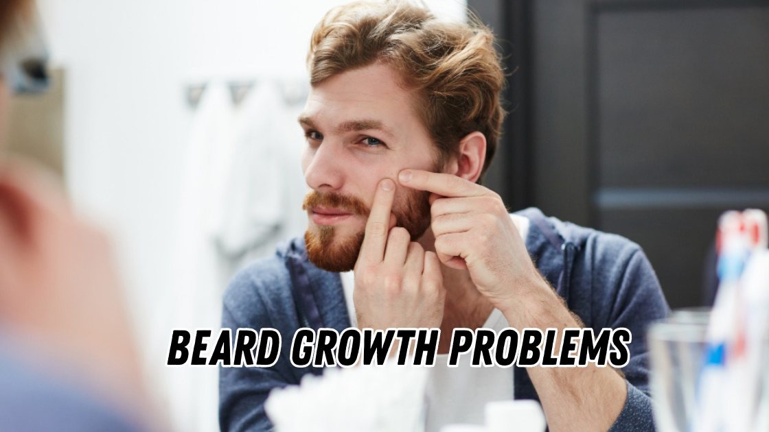 Beard Growth Problems