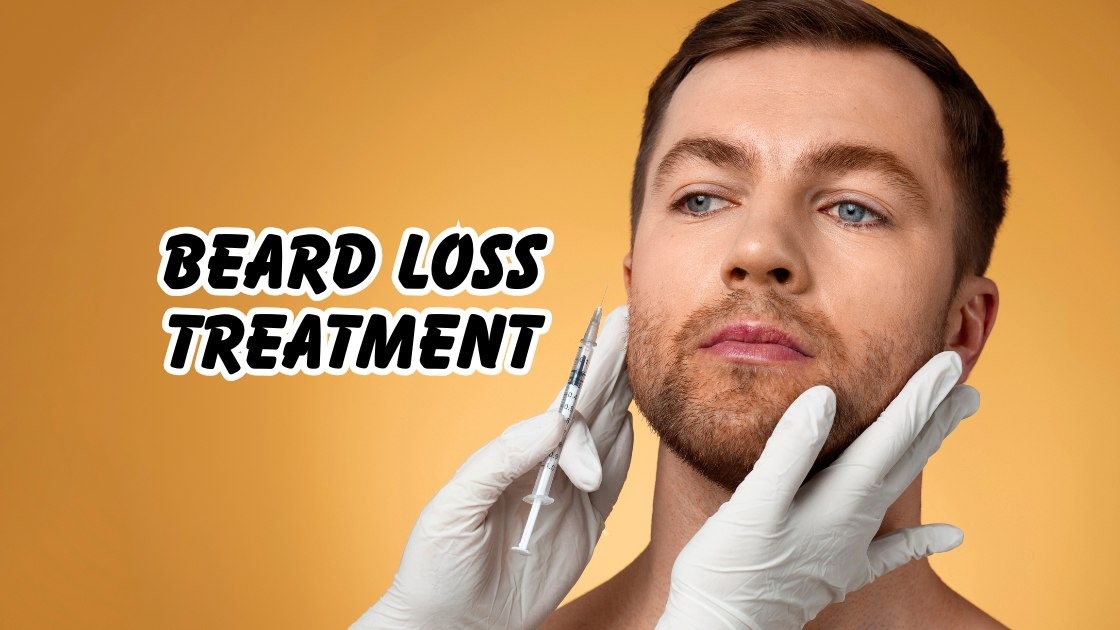 Beard Loss Treatment