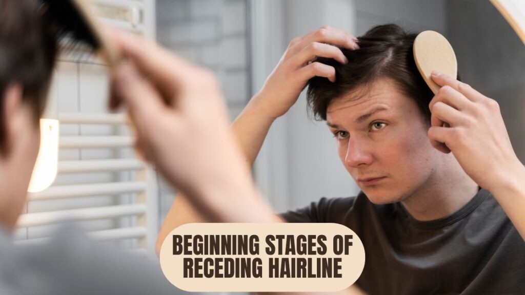 Beginning Stages of Receding Hairline 