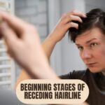 Beginning Stages of Receding Hairline