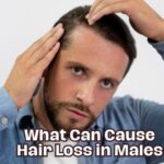 what can cause hair loss in males