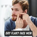 Dry Flaky Face Men