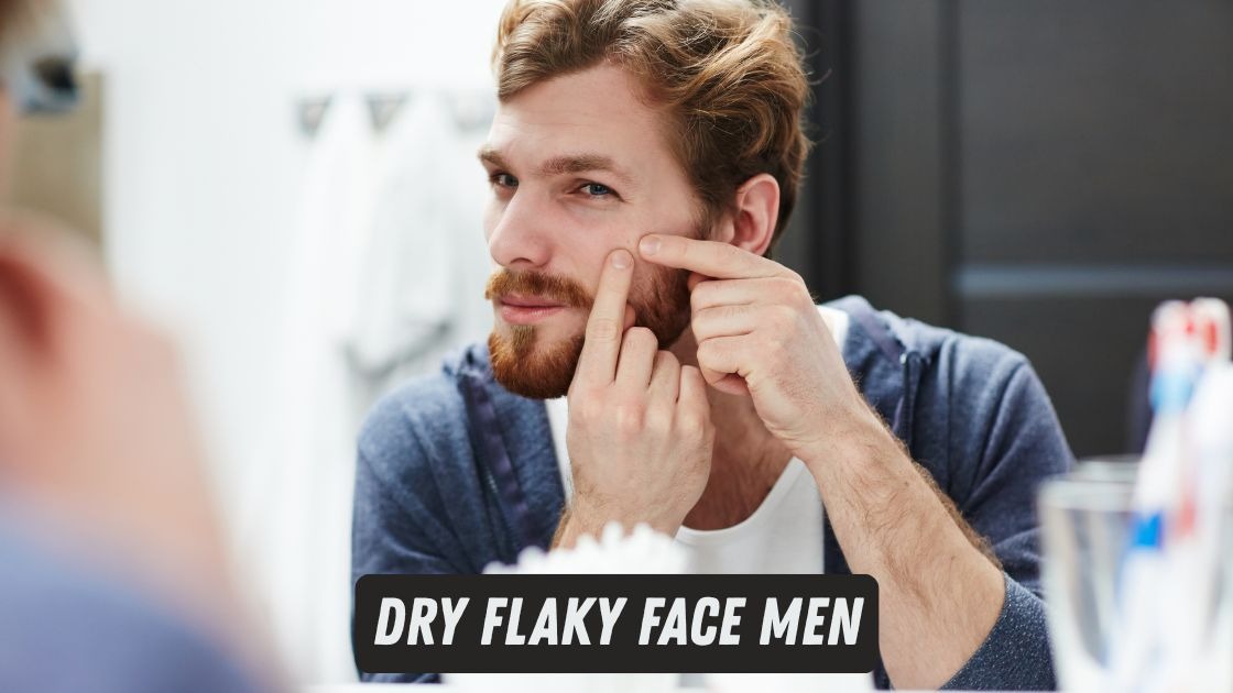 Dry Flaky Face Men