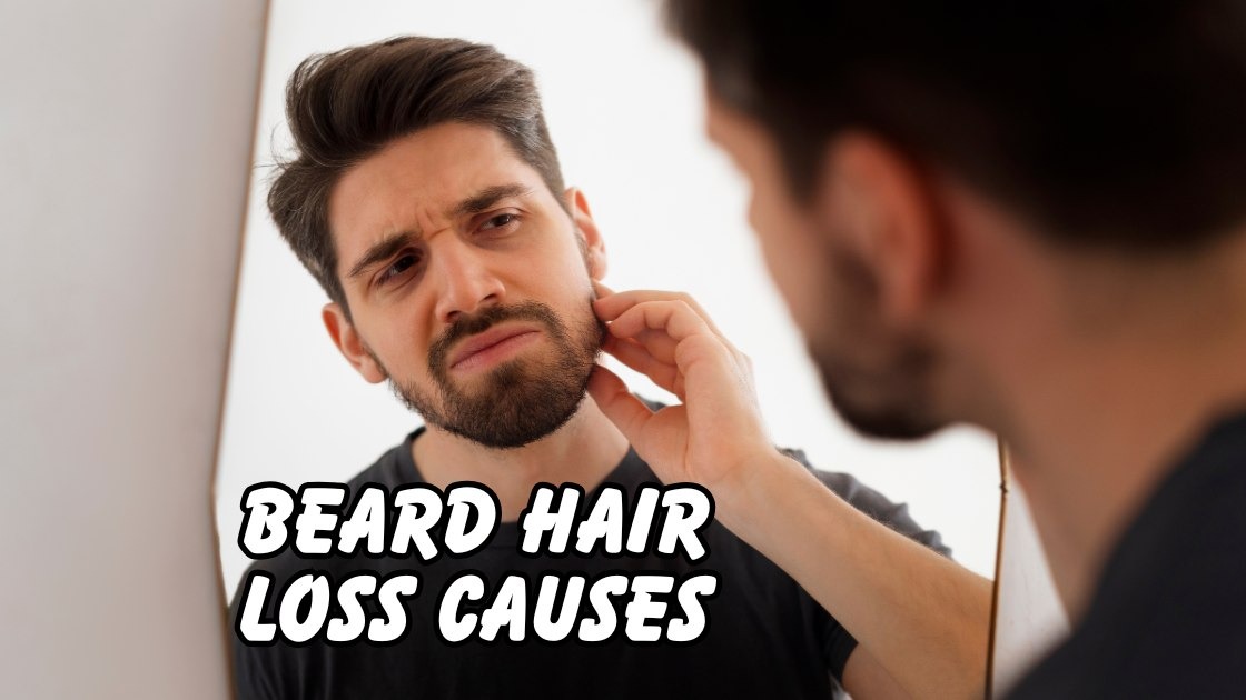 beard hair loss causes