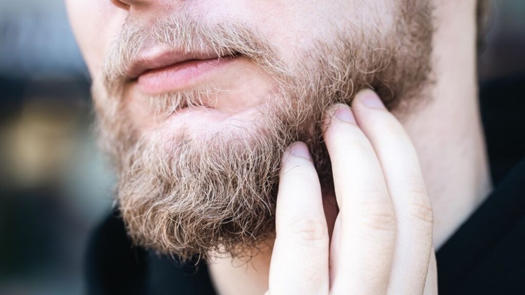  genetically patchy beards