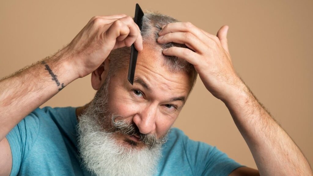 Receding hairline
